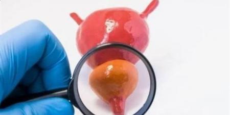 اكتشاف
      علمي
      لأحد
      «محركات»
      سرطان
      البروستاتا...
      يمهد
      لعلاجات
      أكثر
      دقة