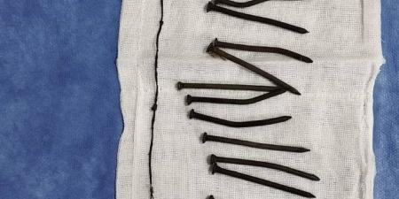 بلعتهم
      45
      يوما..
      استخراج
      34
      مسمارا
      من
      معدة
      مريضة