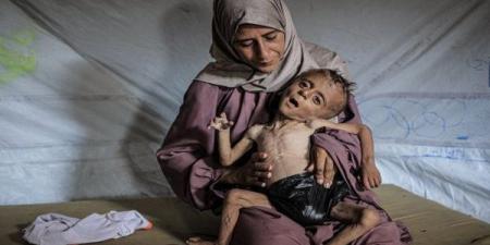 إصابة
      طفلة
      فلسطينية
      برصاص
      الاحتلال
      الإسرائيلي
      في
      دولة
      فلسطين