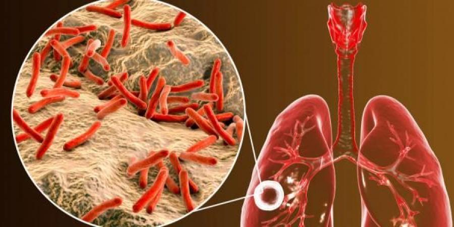 باحثون يتوصلون لسر قدرة بكتيريا السل على البقاء