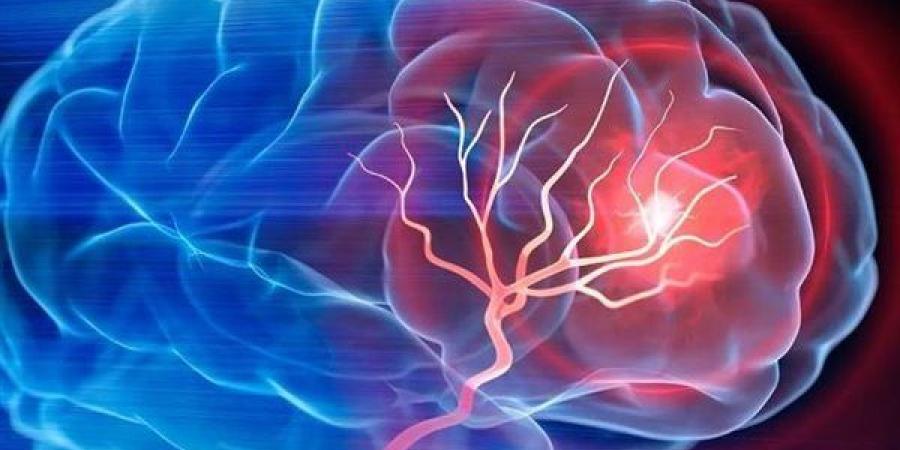 السمنة
      في
      الصغر
      تهدد
      السيدات
      بالسكتة
      الدماغية